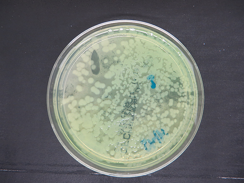 unregelmäßig geformte, flache, leicht grünlich glänzende Bakterienkolonien auf Nähragar
